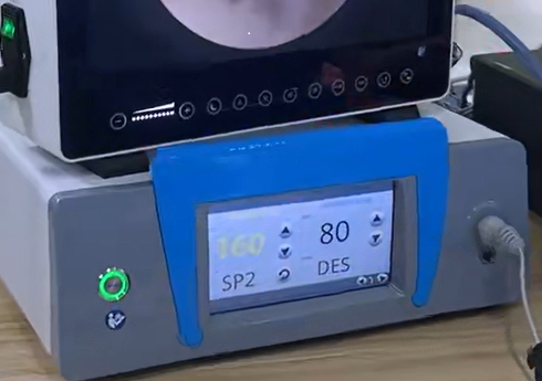 UBE大体示教讲解活动报名通知